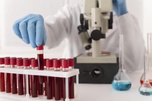 Hematocrit