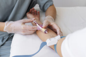 Hematocrit