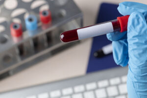 Hematocrit