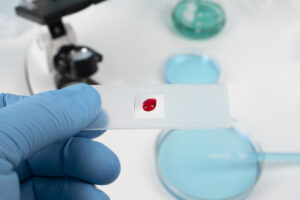 Hematocrit