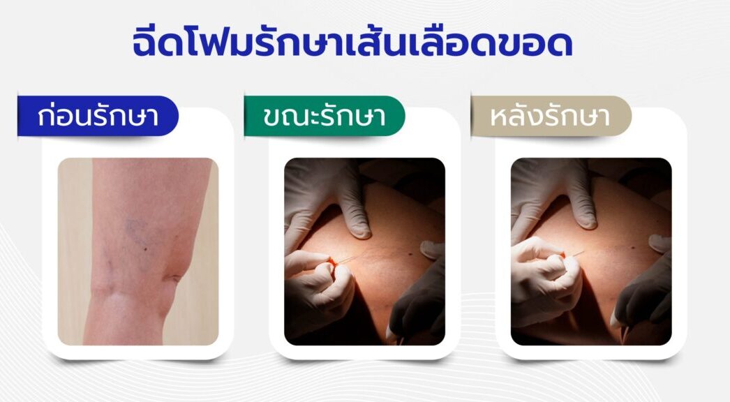 ศูนย์รักษาโรคหลอดเลือดและปลูกถ่ายไต สินแพทย์