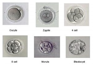 blastocyst culture