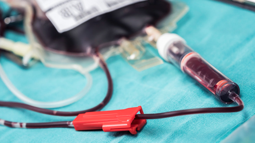 การฟอกเลือดที่โรงพยาบาล กับนวัตกรรมล้างไตที่ช่วยขจัดของเสียในเลือดได้มากยิ่งขึ้น
