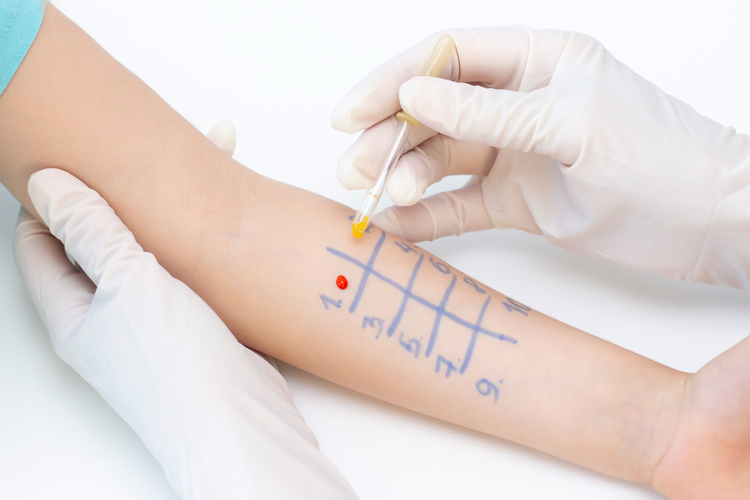 Skin Test สินแพทย์